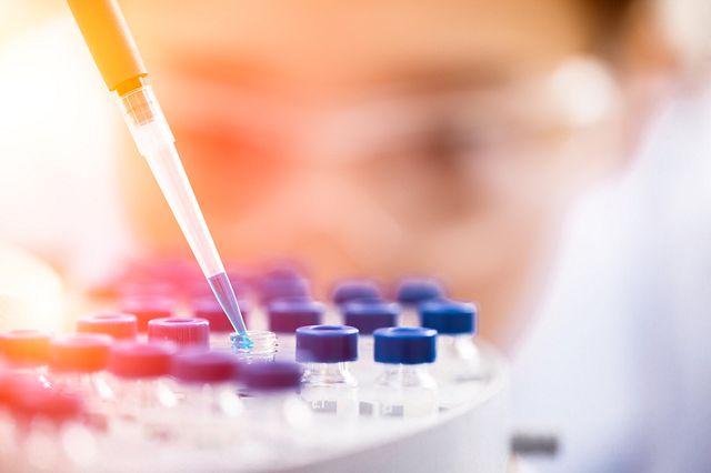 La scienza e i segreti dietro ai test antidroga
